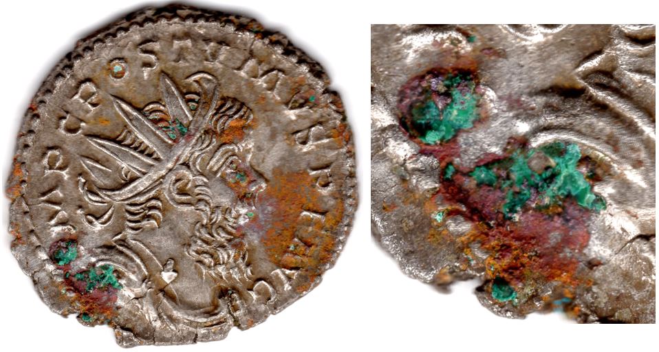 Removing-Verdigris-From-A-Postumus-Antoninianus