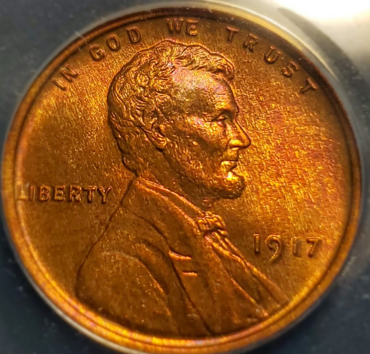 1917-1c-You-Vs.-ANACS