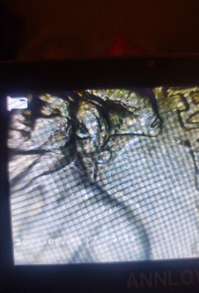 Backside-Error-1976-Quarter