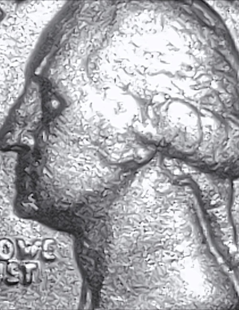 1981-P-Quarter-Possible?