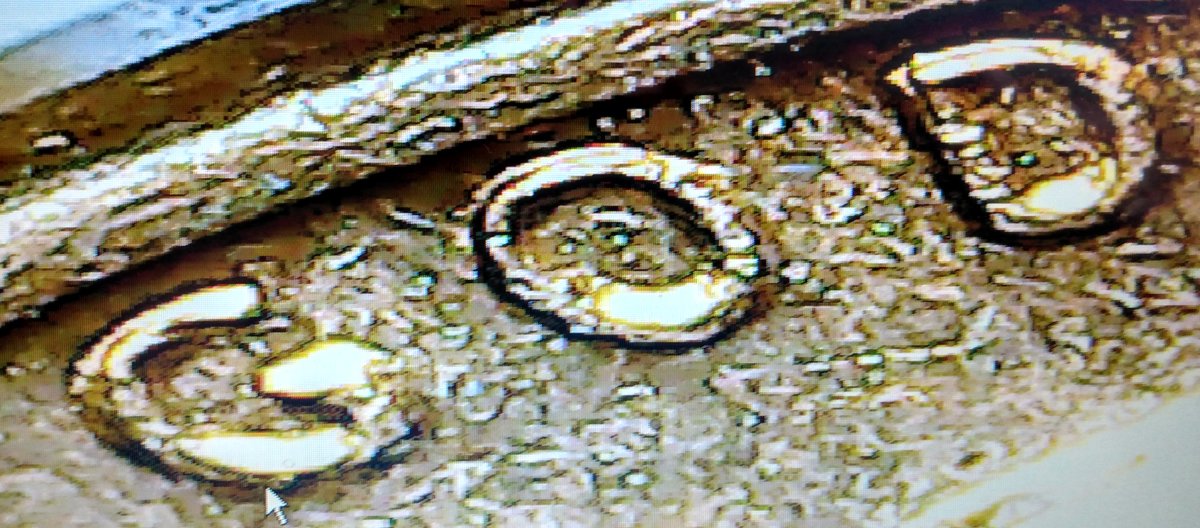Possible-DDO/RPM-On-1972-S-Penny