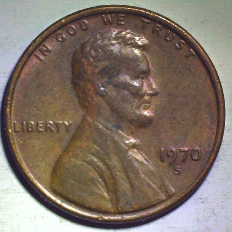 Abe-Has-The-Measles-And-Why-Can't-People-Count!