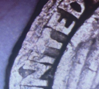 1987-P-Quarter---PMD?