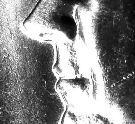 1972-D-Kennedy-Half-Dollar-DDO