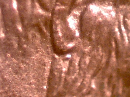 1993-LMC-Help/Quick-Opinions-On-Identifying-Raised-Shape-Under-Ear