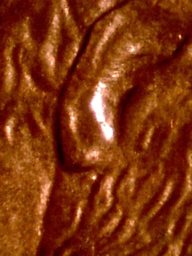 1993-LMC-Help/Quick-Opinions-On-Identifying-Raised-Shape-Under-Ear