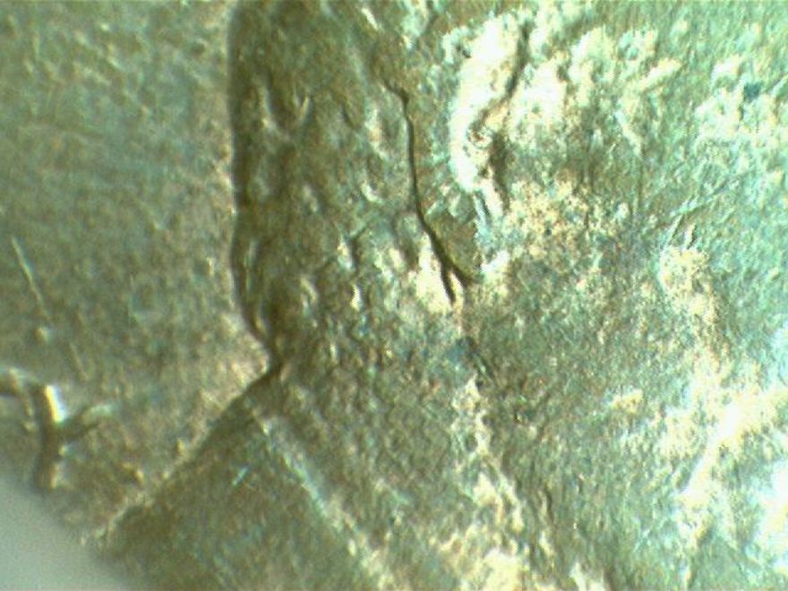 84-Lin---Ear-Lobe-?--What-Is-It-?