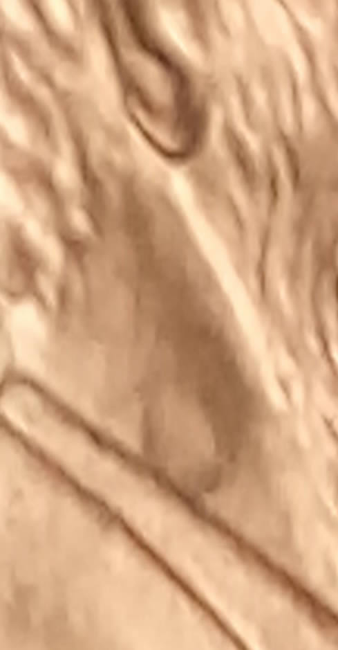 1993-Lincoln-Cent-Lincoln's-Neck-?