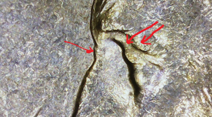 1994-D-Quarter.-Possible-DDO.-Extra-Thickness-Of-Letters/Date,-Tip-Of-Nose,-Extra-Eyebrow?