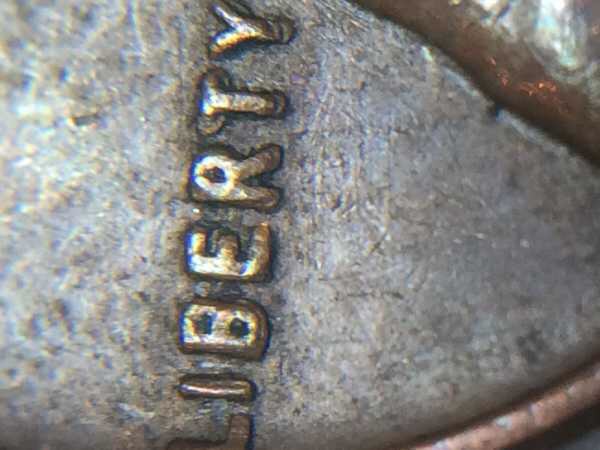Severe-MD