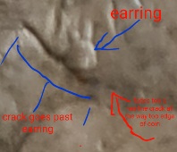 2011-Australian-20-Cent-Crack-From-Hair-Under-Earlobe-Similar-Too-The-$2