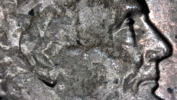 1985-D-LMC.-Is-This-DD-Ear-Or-Just-PMD?-Helps
