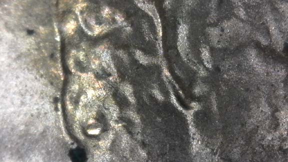 1985-D-LMC.-Is-This-DD-Ear-Or-Just-PMD?-Helps