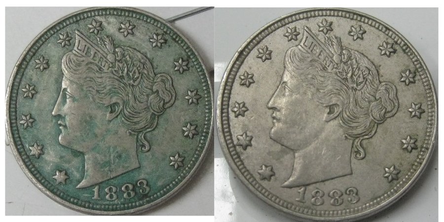 V-Nickel-+-IHC-Before-&-After-Verdi-Care-/-Acetone-Treatment