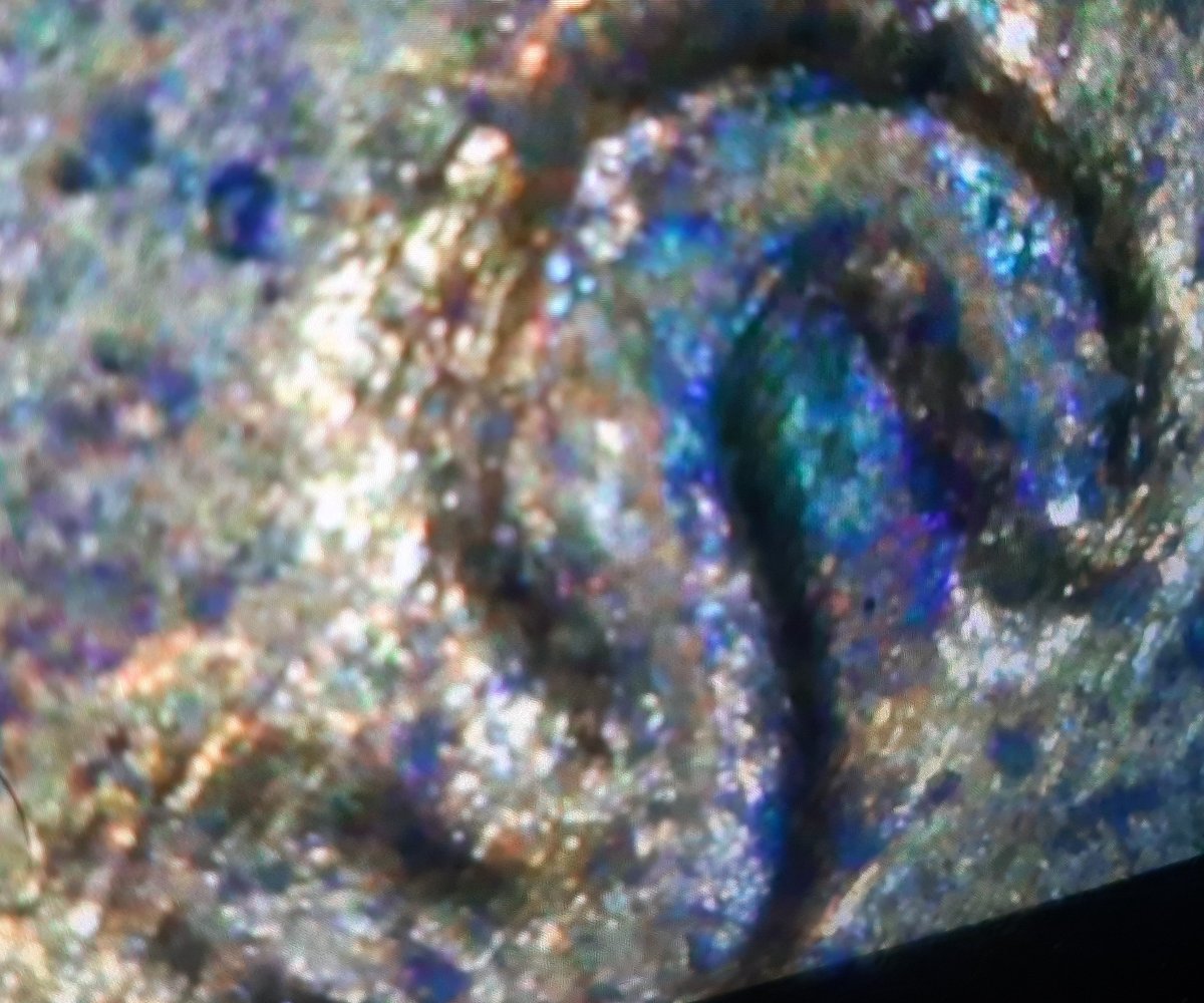 1982-D-RPM-?-DDO?ddr?-Worth?-Please-Enlighten.