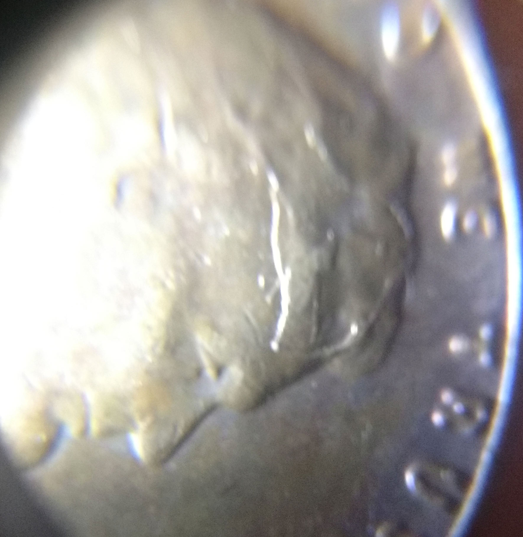 1955-Penny-With-Stamped/Imprint-On-Forehead-&-Hairline-Area?