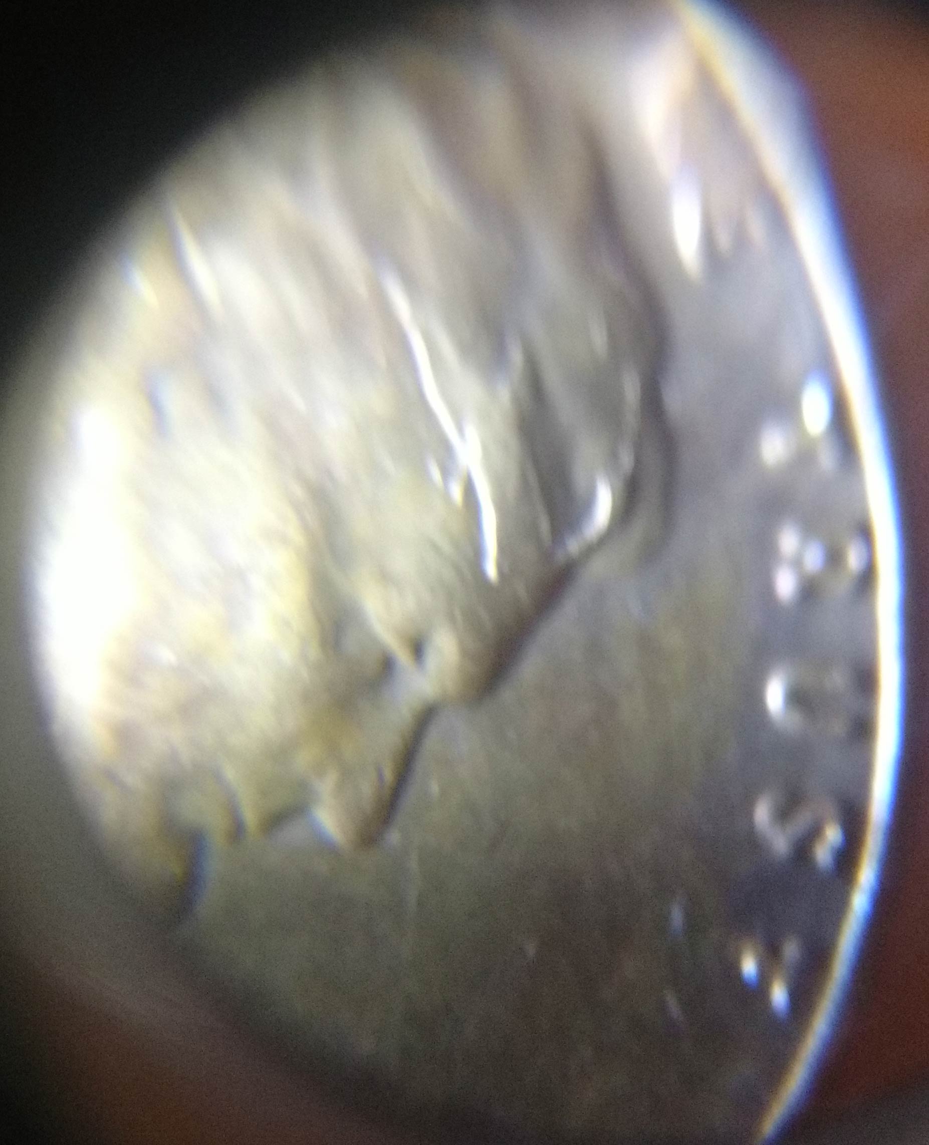 1955-Penny-With-Stamped/Imprint-On-Forehead-&-Hairline-Area?