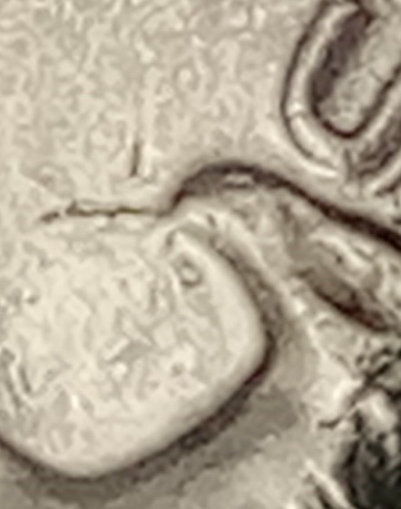 1981-P-Uncirculated-Spitting-Eagle-Quarter-With-Other-Errors?