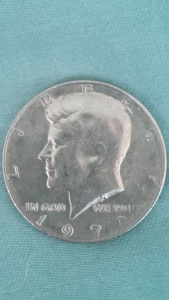 1979-Kennedy-Half-Missing-The-Ear?-Grease-Strike?