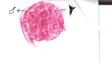 Aelius-?