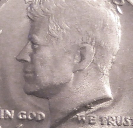 Any-Idea-What-Could-Have-Caused-This-On-This-Kennedy?