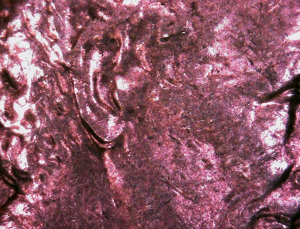 1984-Doubled-Die-Obverse-Penny---Extra-Ear-Lobe
