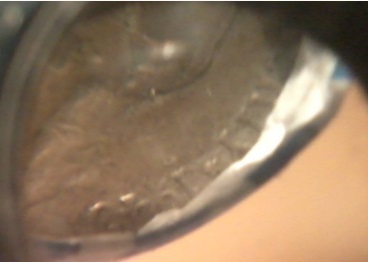 Pictures-Of-End-Roll-Finds