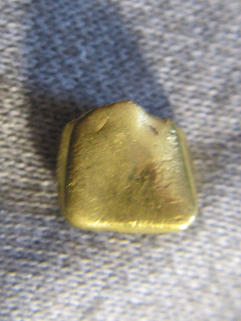 Gold-Capped-Tooth-Find