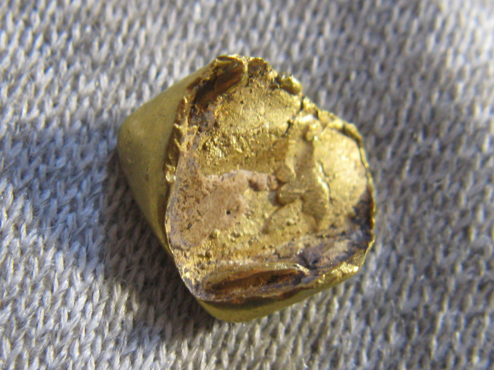 Gold-Capped-Tooth-Find