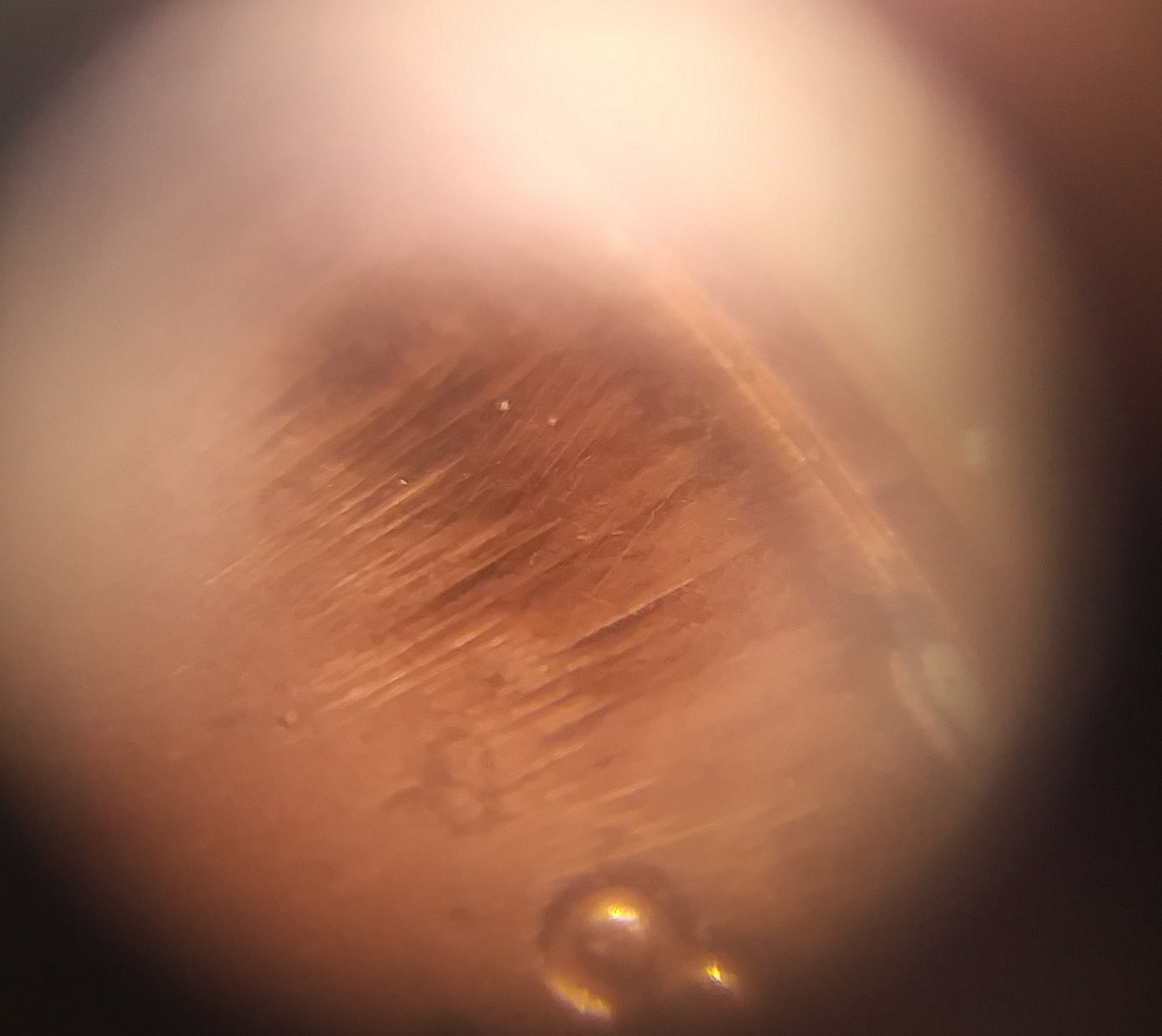 Is-This-A-Form-Of-Die-Error-On-2018-LMC-?