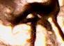 1974-Lincoln-Cent-Double-Eyelid