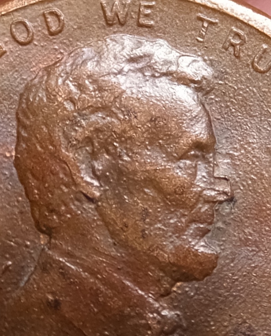 1984-LMC,-What-Happend-To-His-Nose?