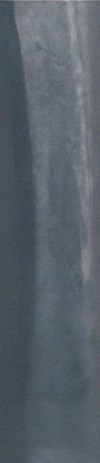 1999-LMC.-Could-This-Be-A-Collar-Scar?