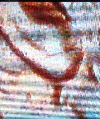 1992-D-LMC-Doubled-Ear