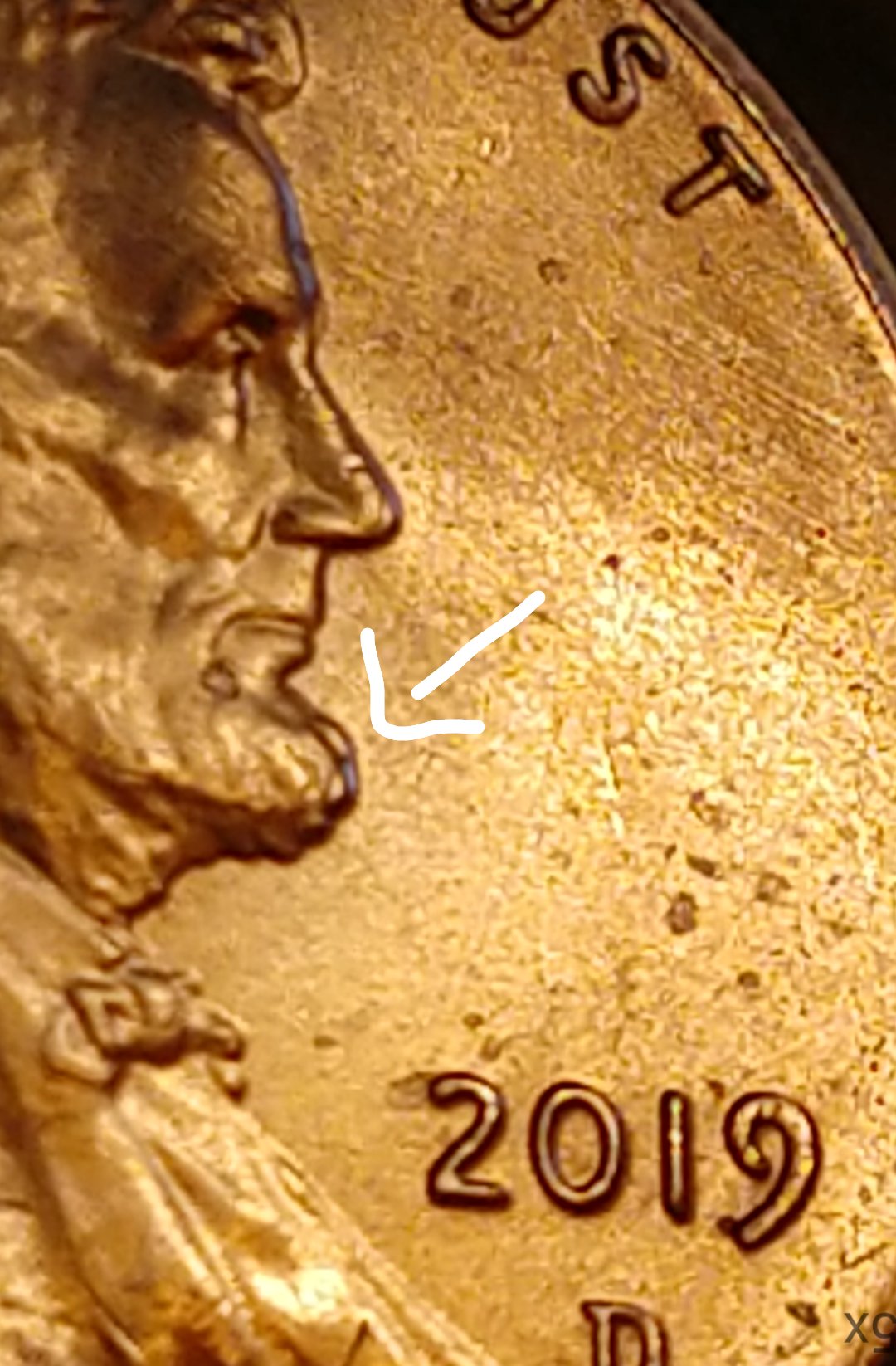 2019-D-Lincoln-Has-A-Pimple