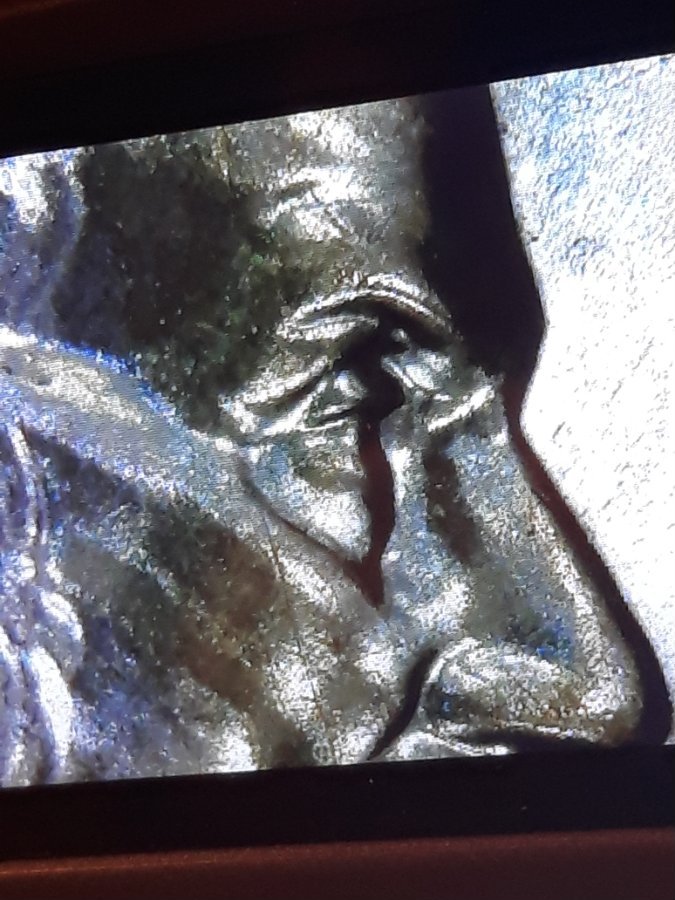 2001-D-LMC-Doubled-Eyelid-Or-Split-Plate-Bubbling?