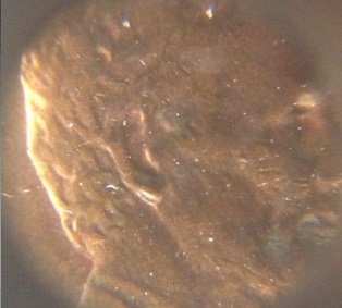 1984-LMC-Earlobe