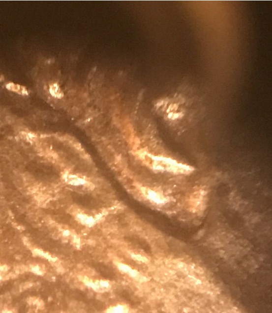 I-Have-This-1984-Cent-And-Not-Sure-If-There-Is-A-Double-Ear?