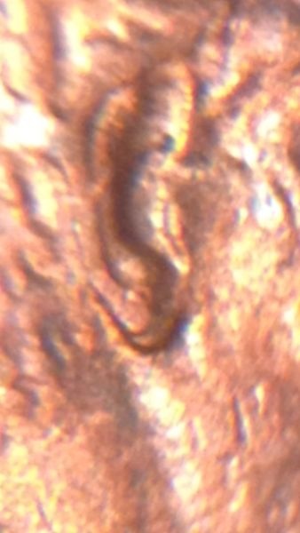 1985-P-DDO-Earlobe?
