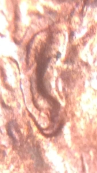 1985-P-DDO-Earlobe?