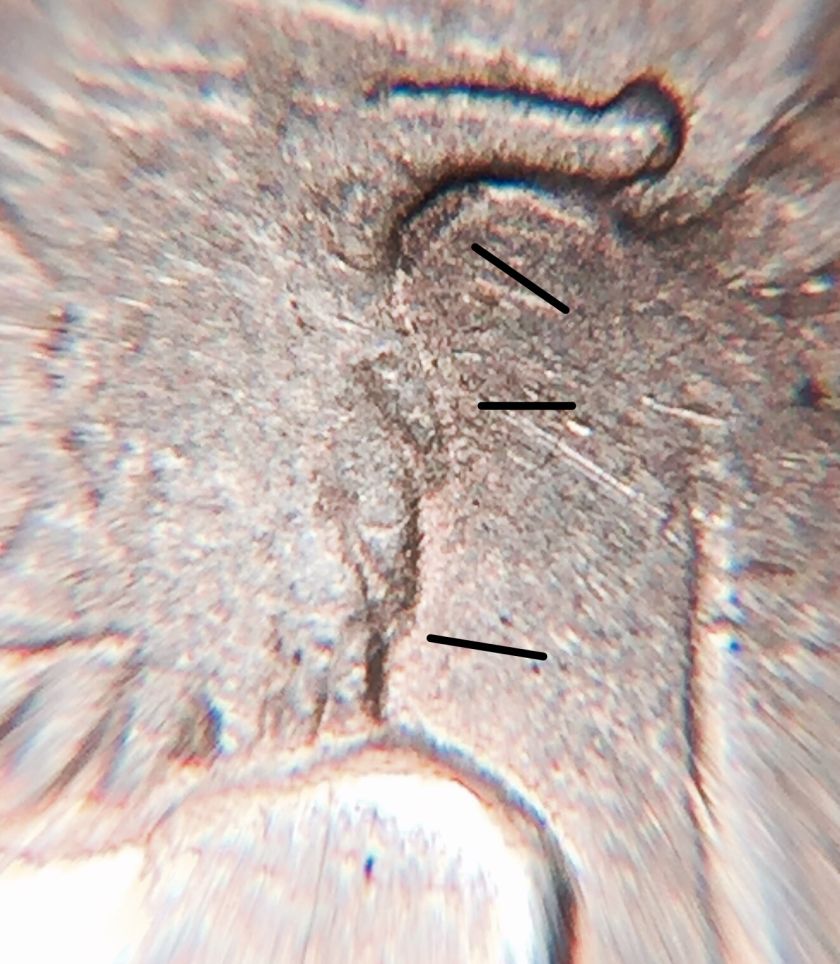 1921-Morgan-&-1935-Peace-Dollar/Crack-Die/Light-Die-Strike