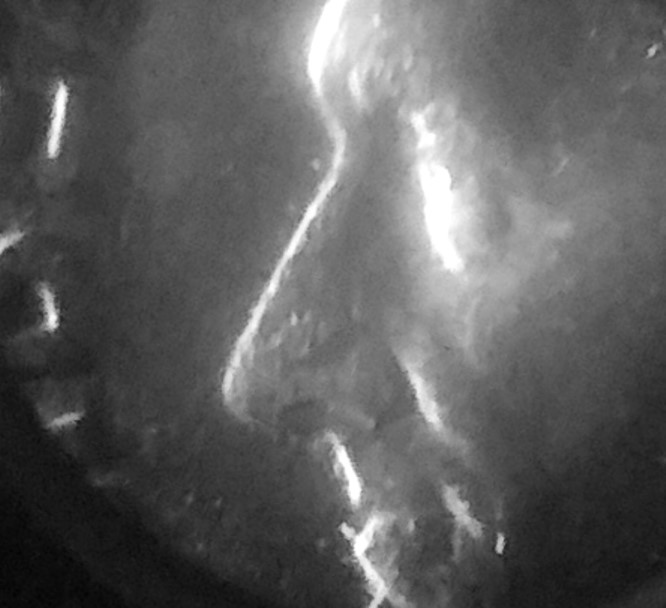 Is-It-Normal-Or-Unusual-For-This-To-Be-On-A-Roosevelt-Dime