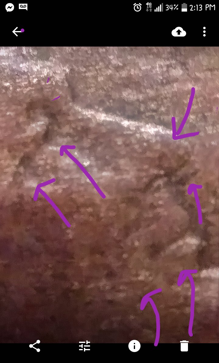 1919--Crying,-2-Faced-Lincoln-Wheat-Penny!?