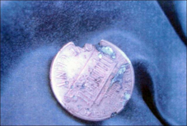 Local-Story---Lincoln-Cents-Burn-Skin-Mystery