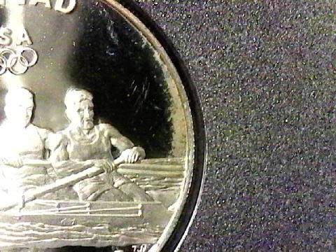 1996-Prestige-Set-Preservation/Cleaning