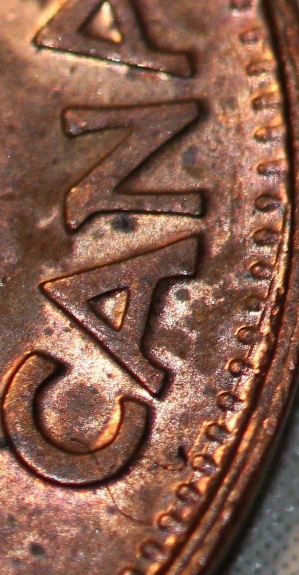 Denticles