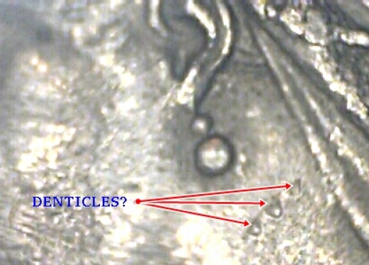 Die-Error-By-Earring-On-Obverse-Of-1887-Half-Crown?