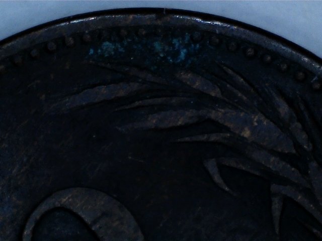 Is-This-Bronze-Disease?