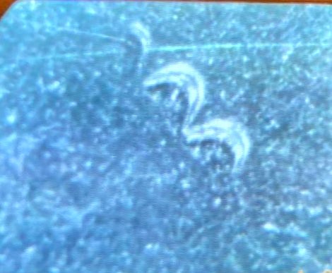 Need-Help-Identifying-Possible-Die-Gouge-On-2023-D-Jovita-Idar-Quarter