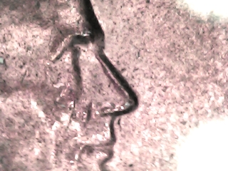 1983-D-Lincoln-Penny-Extra-Nose-Or-The-Dreaded-PMD.